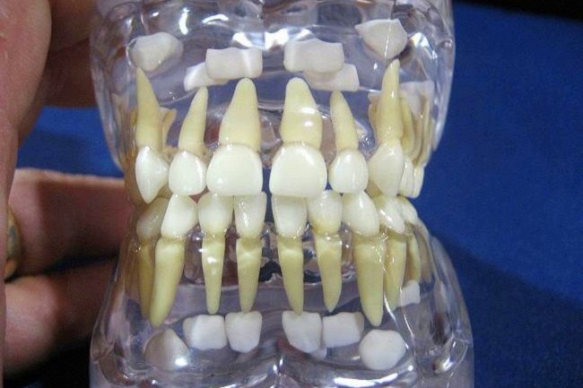 Стоматологическая сенсация: новые зубы можно вырастить в любом возрасте