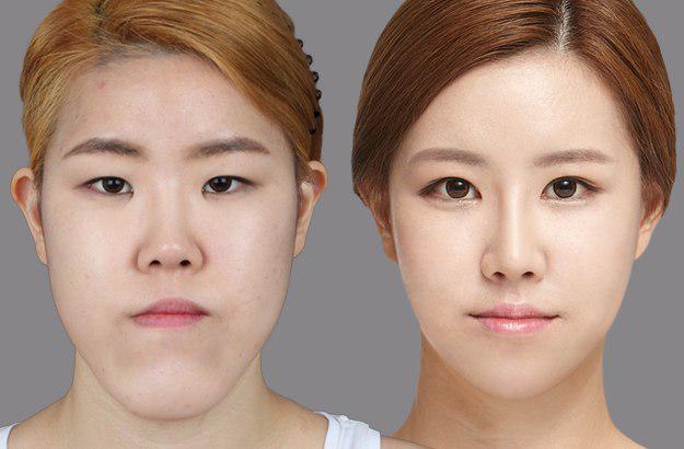 Как создается искусственная красота или 9 Шокирующих Фактов об Корейской Индустрии Красоты