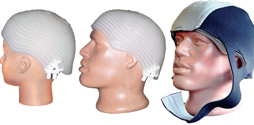 В «Сколково» создали охлаждающий шлем для предотвращения смерти клеток мозга при инсульте