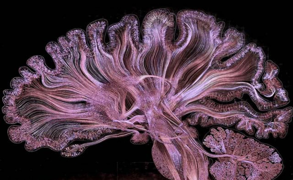 Удивительная визуализация мозга