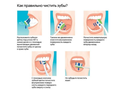 12 способов сохранить зубы здоровыми