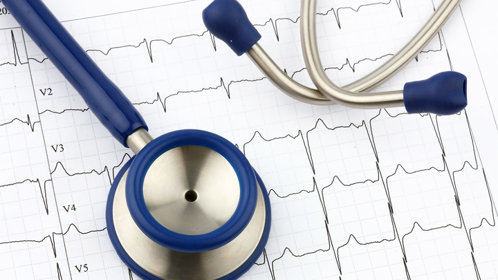 Эксперты подсказали легкий способ снизить риск сердечного приступа