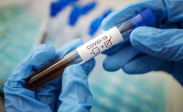 Через час после инаугурации Байдена ВОЗ признала чудовищную ложность ПЦР-тестов на коронавирус