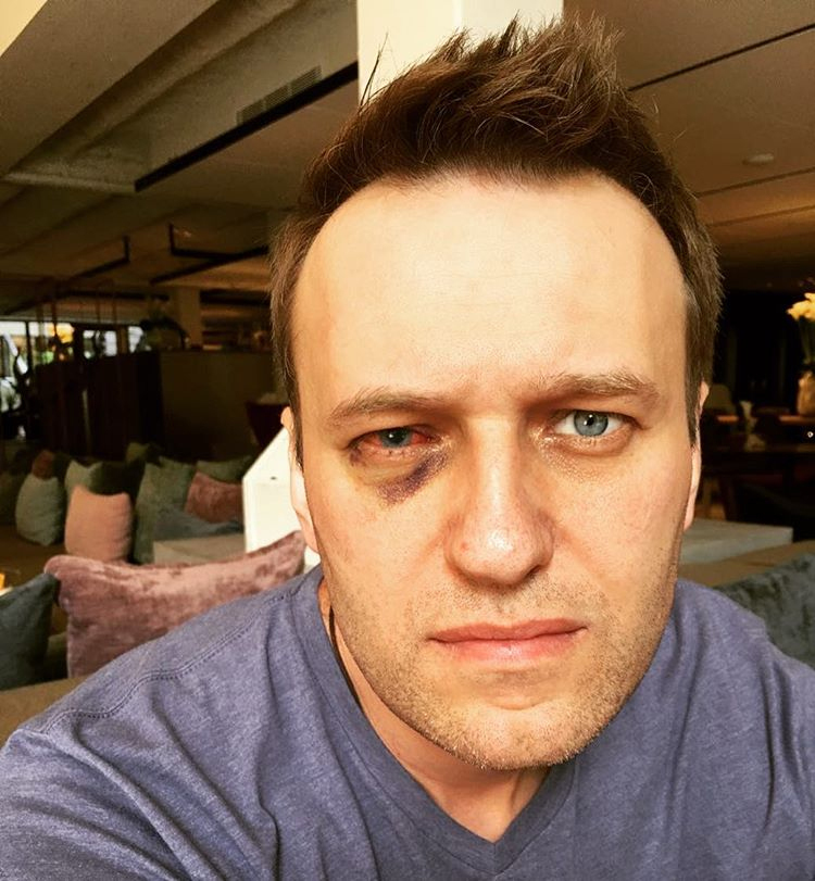 Навальный о своем здоровье: «Уже с кровати встать больно»