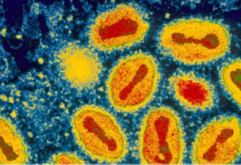 В исследовательском центре в США обнаружили пробирки с образцами вируса оспы