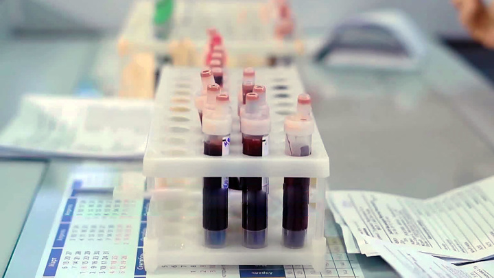 как сдавать общий анализ крови