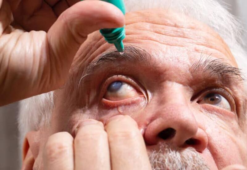 Есть ли связь между катарактой и опасным заболеванием мозга?