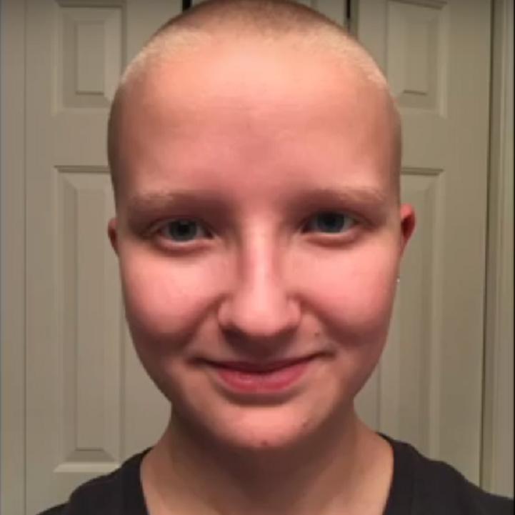 Девушка побрилась налысо, чтобы показать, как вырастают волосы за один год (видео)
