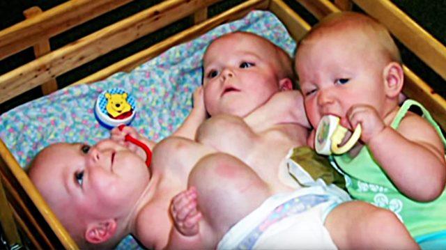 От этих тройняшек отказались родители. Вот, что случилось с сиамскими близнецами и их сестричкой спустя 14 лет.