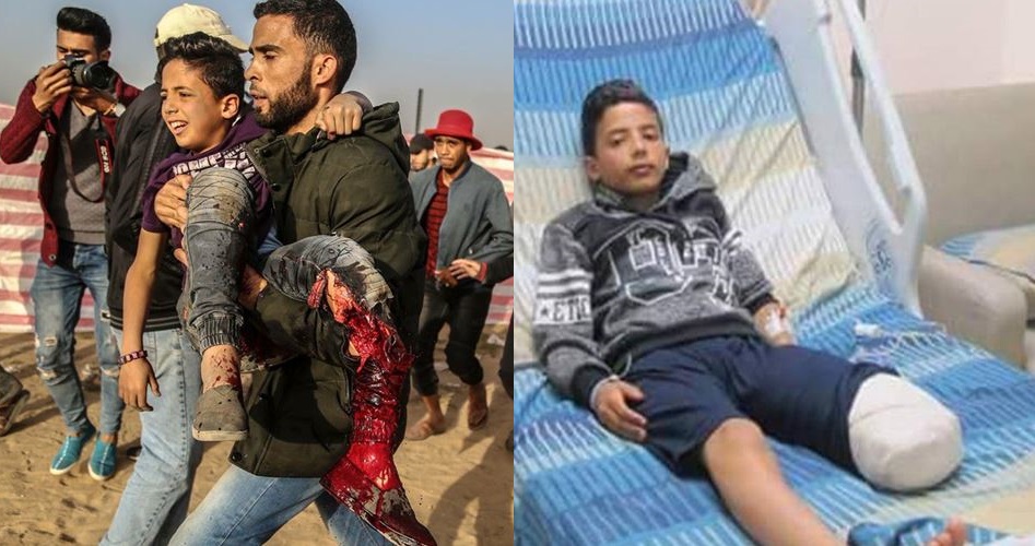 3 мученически погибших и 611 раненых в 5 пятницу массовых палестинских демонстраций