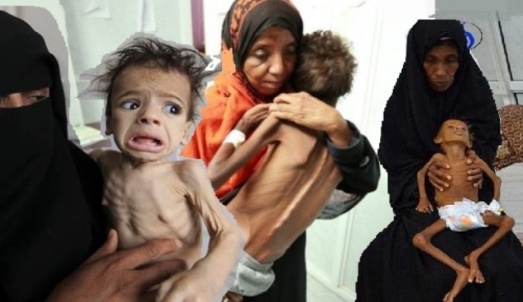 ЮНИСЕФ: Йеменские дети даже в больницах находится не в безопасности