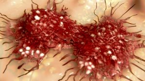 Ученые назвали семь неожиданных причин возникновения рака