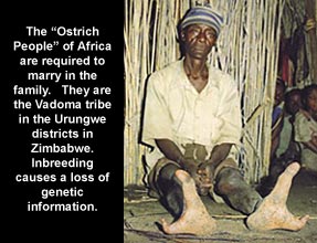 Двупалое племя родом из Зимбабве. Как живут люди с двумя пальцами?