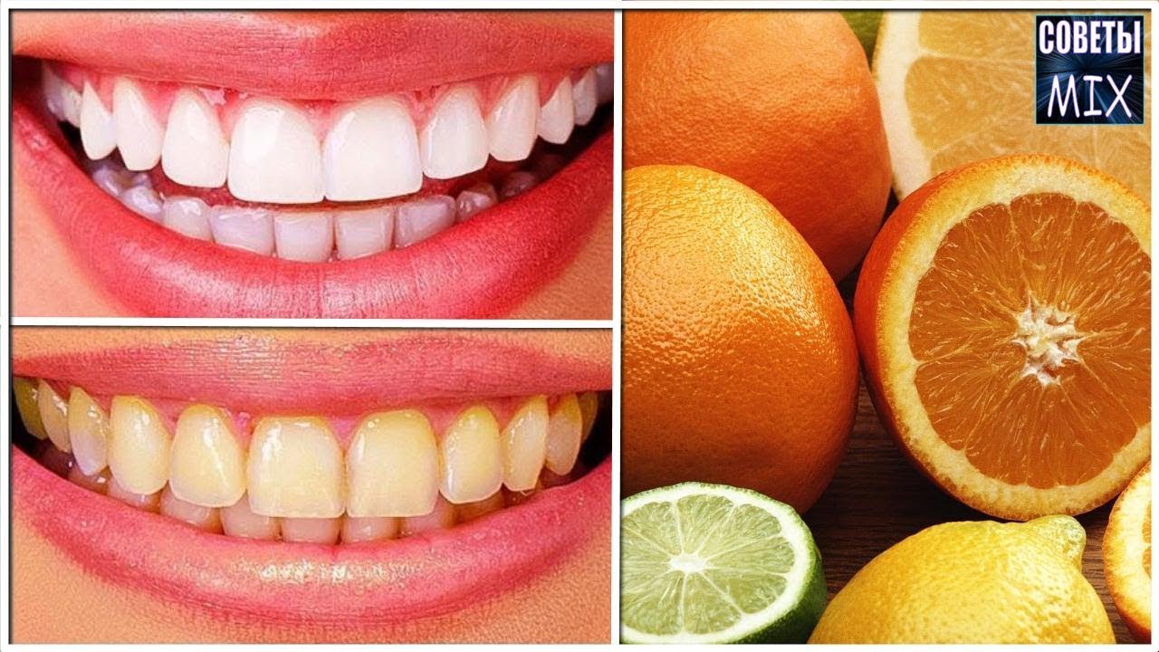 Простые секреты здоровой и белоснежной улыбки. Продукты, которые портят ваши зубы