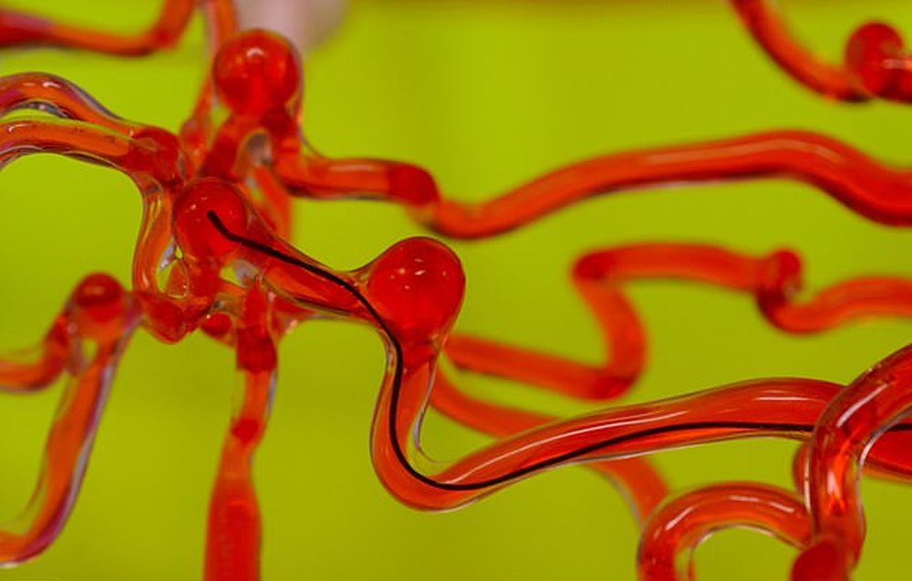 Змееподобный робот очистит сосуды от тромбов и спасет при инсульте